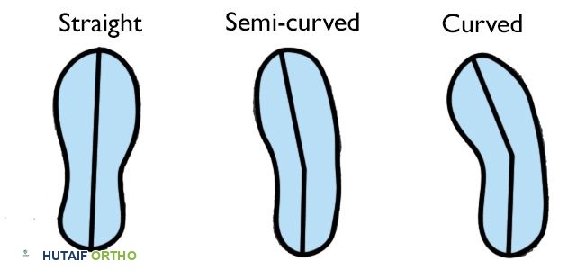 صورة توضيحية لـ الأحذية المناسبة لصحة قدميك وجسمك: دليلك الشامل من الأستاذ الدكتور محمد هطيف في صنعاء