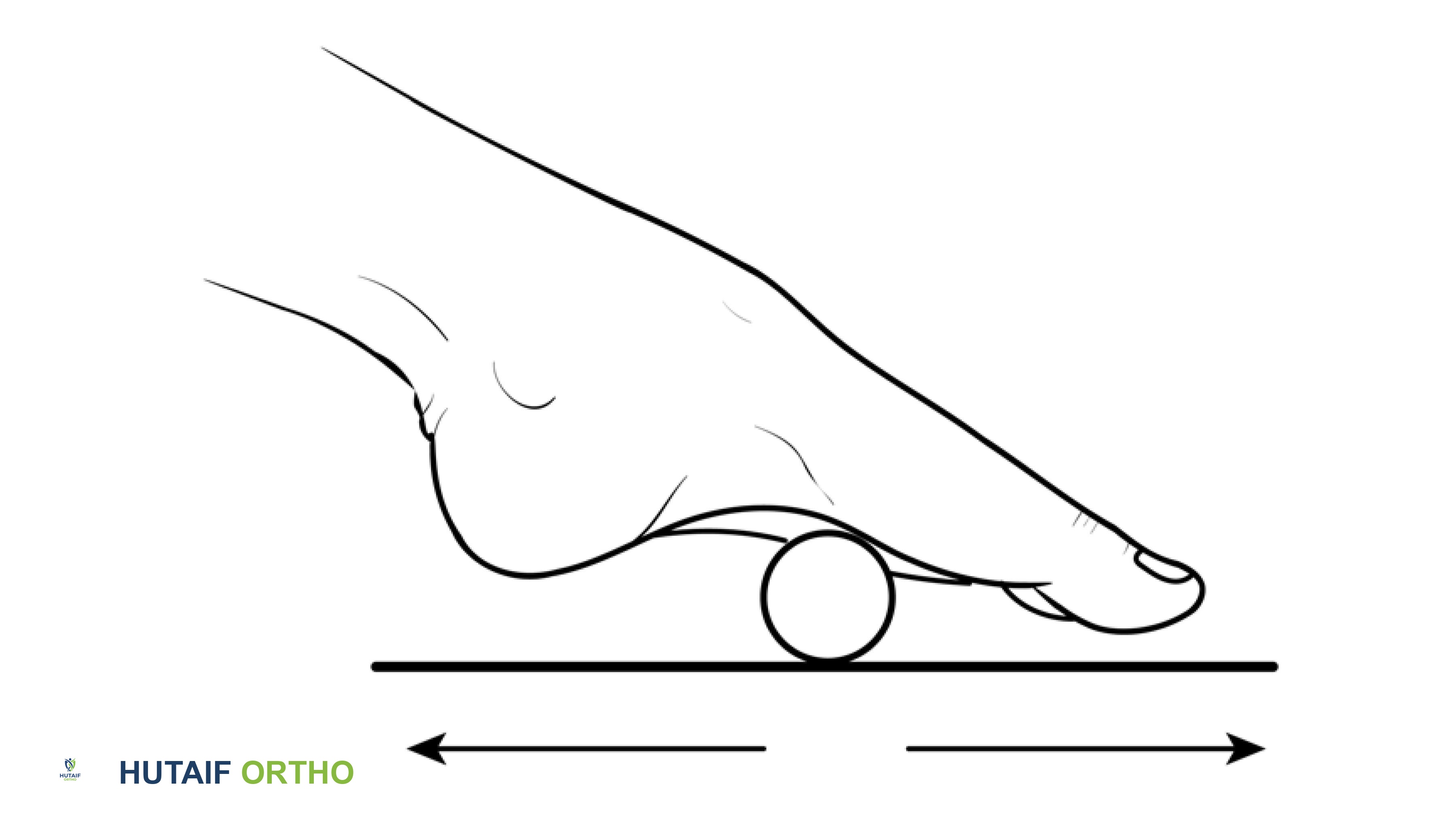 صورة توضيحية لـ برنامج شامل لتقوية وتأهيل القدم والكاحل: دليلك للتعافي في صنعاء مع الأستاذ الدكتور محمد هطيف