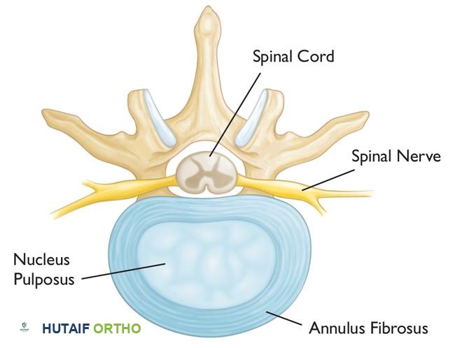 صورة توضيحية لـ الاعتلال الجذري العنقي (انضغاط العصب في الرقبة): دليل شامل من الأستاذ الدكتور محمد هطيف