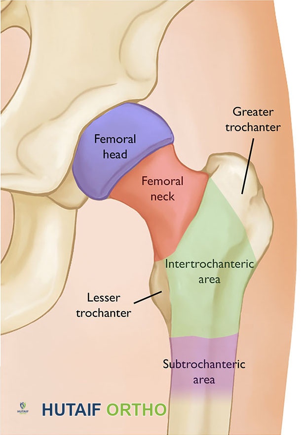 صورة توضيحية لـ كسور الورك: دليل الأستاذ الدكتور محمد هطيف الشامل للتشخيص والعلاج في صنعاء