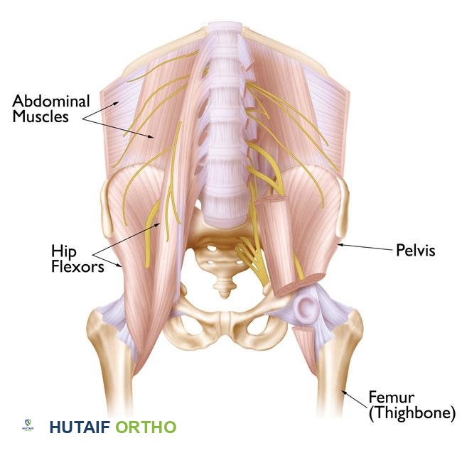 صورة توضيحية لـ إجهاد الورك الأسباب الأعراض والعلاج الشامل مع الأستاذ الدكتور محمد هطيف
