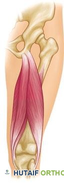 العضلات المأبضية في الجزء الخلفي من الفخذ.