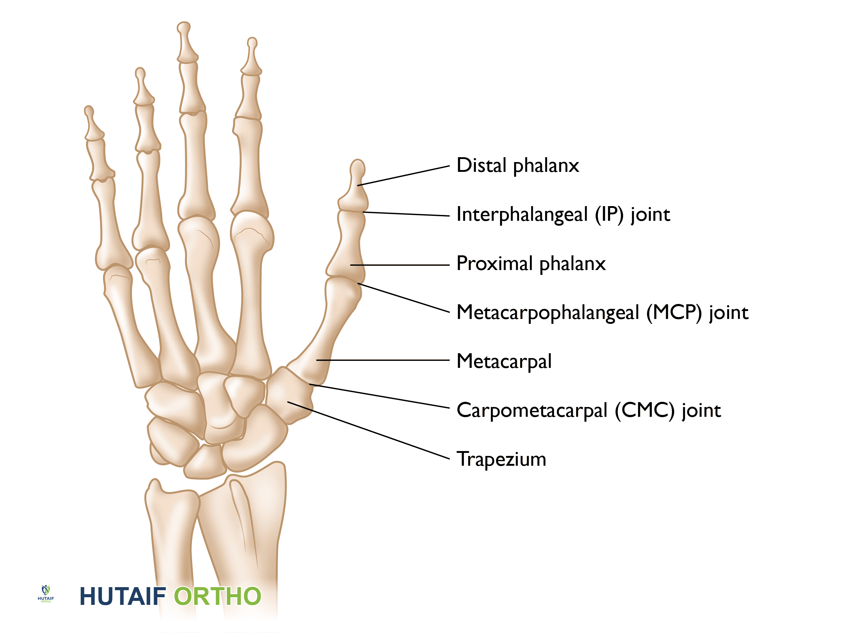 كسور الإبهام: دليل شامل للتشخيص والعلاج والتعافي مع الأستاذ الدكتور محمد هطيف في صنعاء