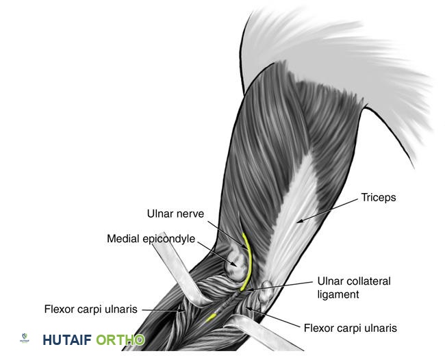 مسار العصب الزندي عبر النفق المرفقي