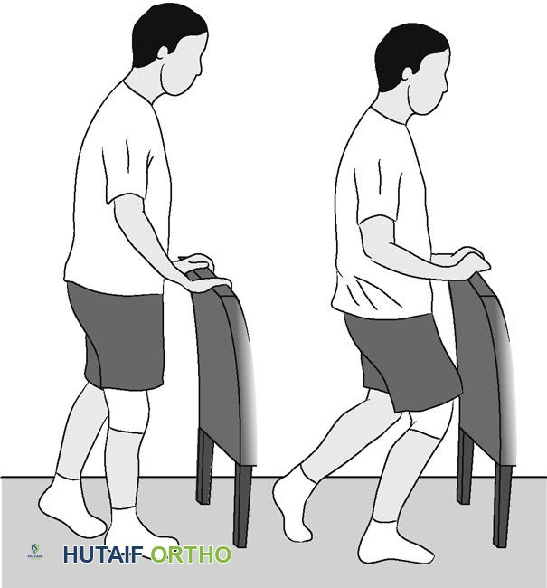 صورة توضيحية لـ تمارين منظار الركبة: دليلك الشامل للتعافي واستعادة قوة ركبتك في صنعاء مع الأستاذ الدكتور محمد هطيف