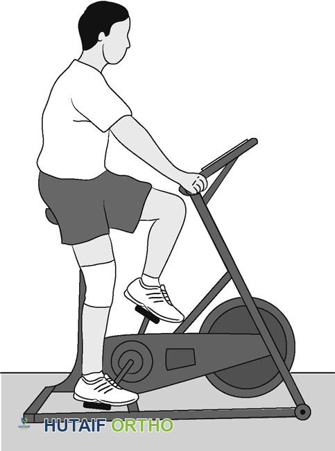 صورة طبية: تمارين منظار الركبة: دليلك الشامل للتعافي واستعادة قوة ركبتك في صنعاء مع الأستاذ الدكتور محمد هطيف