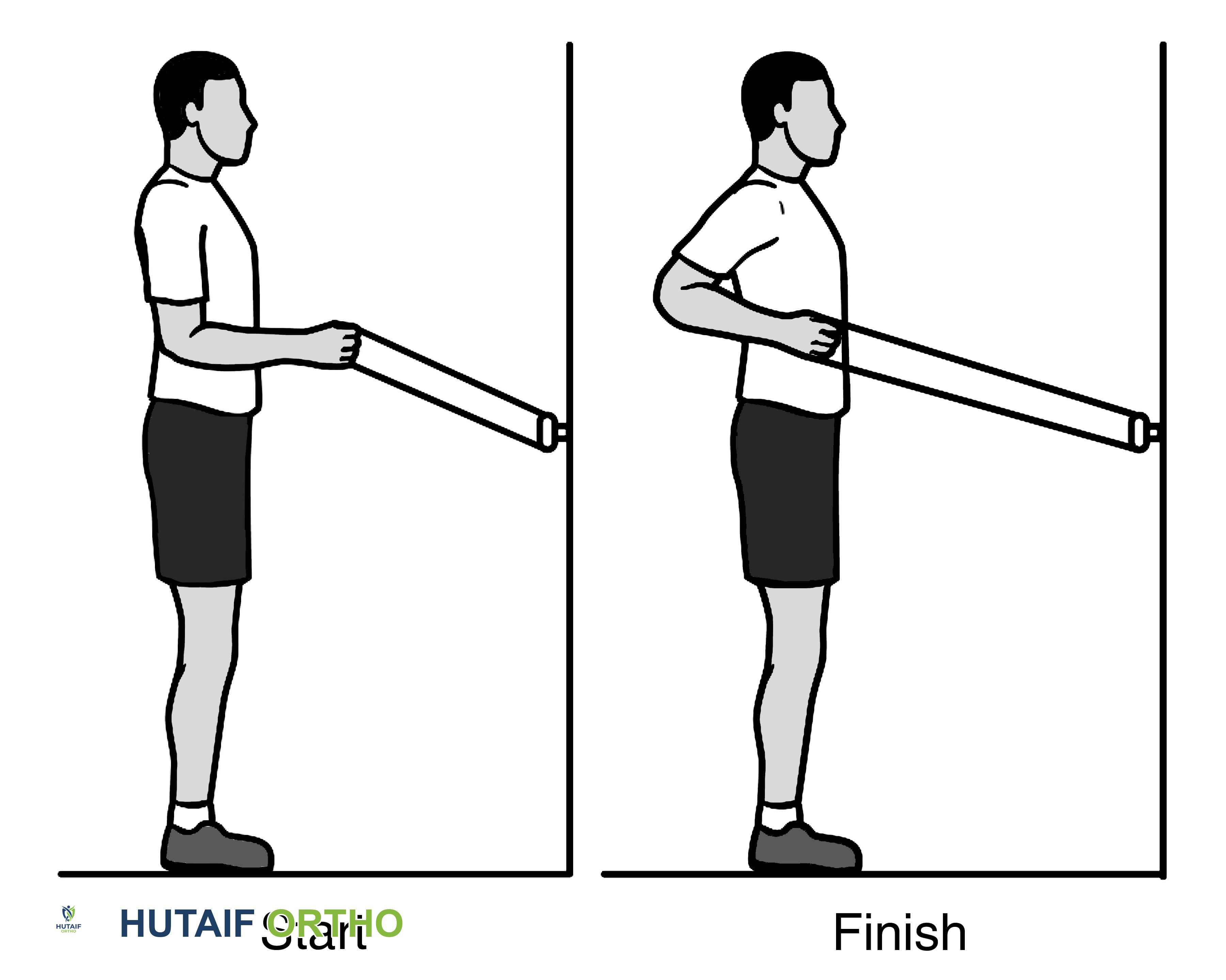 صورة طبية: تمزق الكفة المدورة بالكتف: دليلك الشامل للعلاج والتعافي مع الأستاذ الدكتور محمد هطيف في صنعاء