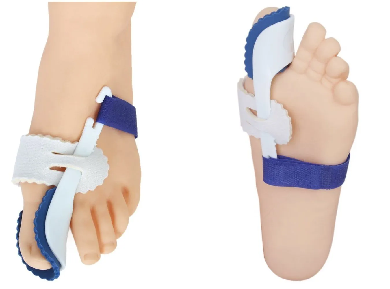 Hallux Valgus Splint (Night-time)