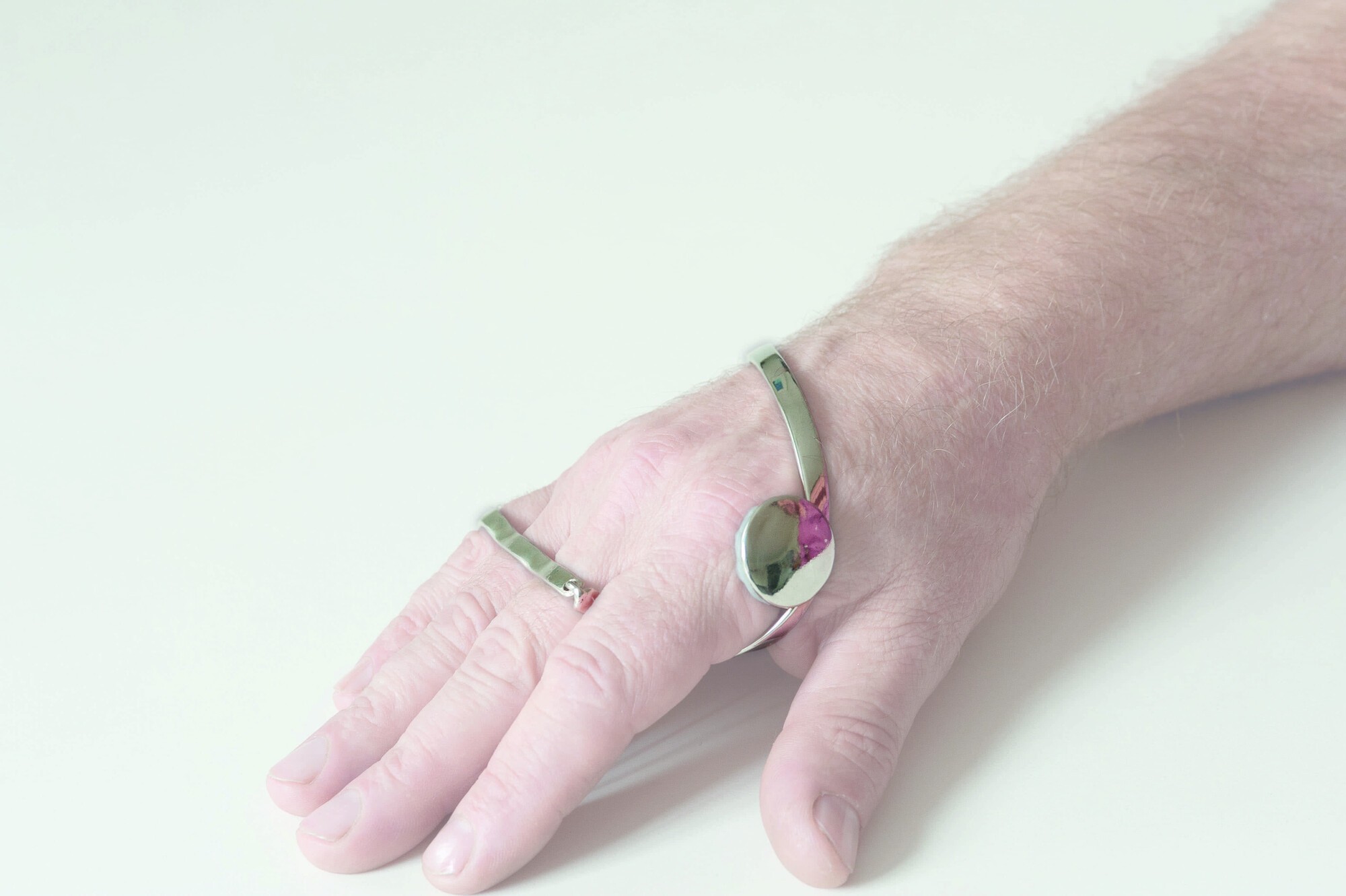 Wrist Drop Splint (Dynamic MCP Extension)