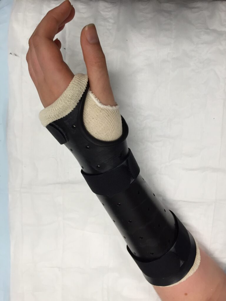 Wrist Thumb Brace (Short Opponens)