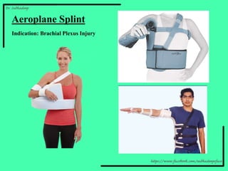 Airplane Splint
