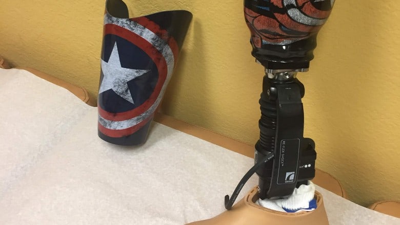 Microprocessor Knee (e.g., C-Leg)