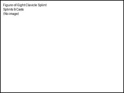 Figure-of-Eight Clavicle Splint