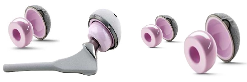 تخلص من الألم: استبدال مفصل الورك والحوض لتعافٍ كامل وحياة أفضل