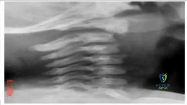 Orthopedic Prometric Exam Chapter 3 Image