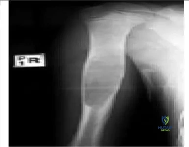 Orthopedic Prometric Exam Chapter 3 Image