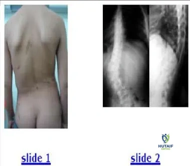 Orthopedic Prometric Exam Chapter 3 Image