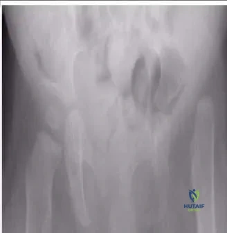 Orthopedic Prometric Exam Chapter 3 Image