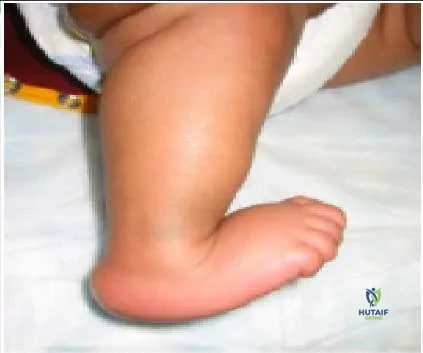 Orthopedic Prometric Exam Chapter 3 Image