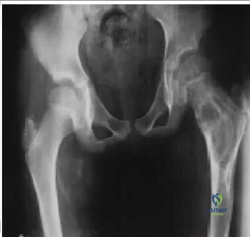 Orthopedic Prometric Exam Chapter 3 Image