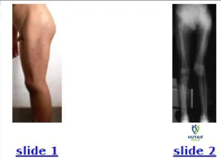 Orthopedic Prometric Exam Chapter 3 Image