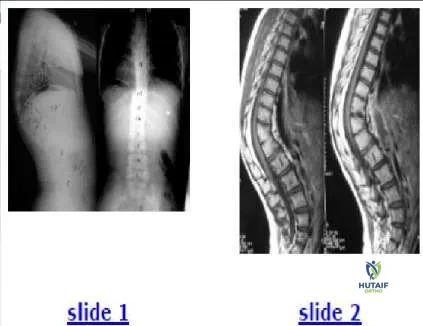 Orthopedic Prometric Exam Chapter 3 Image