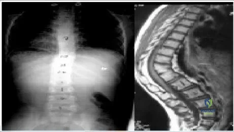 Orthopedic Prometric MCQs - Chapter 3 Part 15