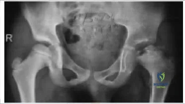 Orthopedic Prometric Exam Chapter 3 Image