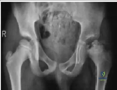 Orthopedic Prometric Exam Chapter 3 Image