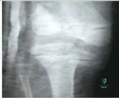 Orthopedic Prometric Exam Chapter 3 Image