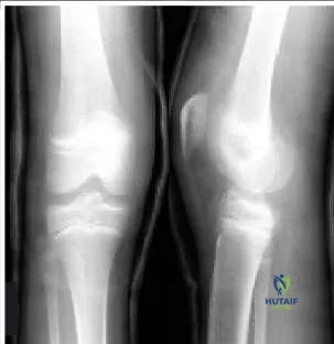 Orthopedic Prometric Exam Chapter 3 Image