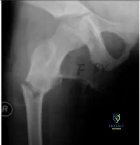 Orthopedic Prometric Exam Chapter 3 Image