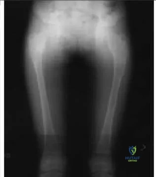 Orthopedic Prometric Exam Chapter 3 Image