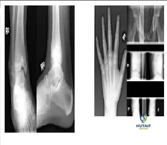 Orthopedic Prometric Exam Chapter 3 Image