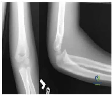 Orthopedic Prometric Exam Chapter 3 Image