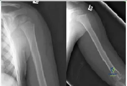 Orthopedic Prometric Exam Chapter 3 Image