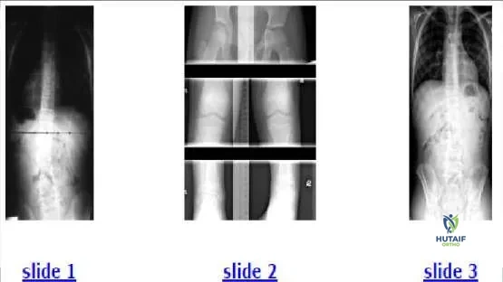 Orthopedic Prometric Exam Chapter 3 Image