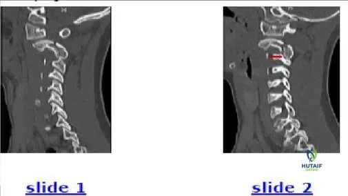 Orthopedic Prometric Exam Chapter 3 Image