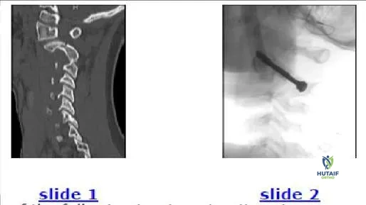 Orthopedic Prometric Exam Chapter 3 Image