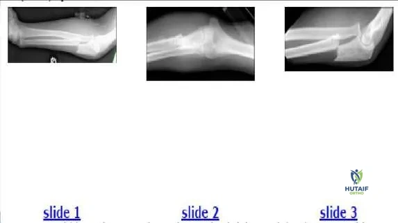 Orthopedic Prometric Exam Chapter 3 Image