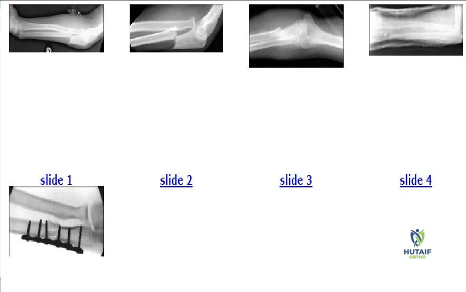 Orthopedic Prometric Exam Chapter 3 Image