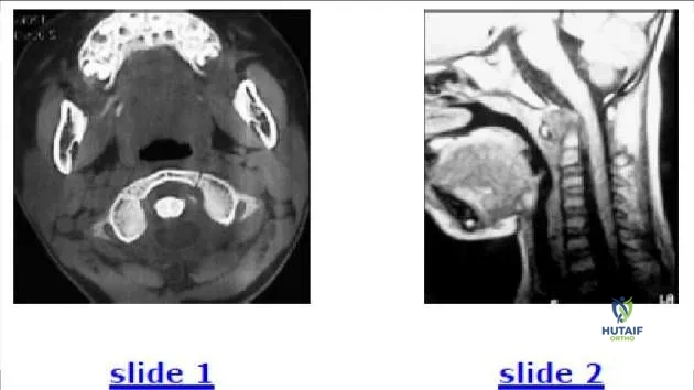 Orthopedic Prometric Exam Chapter 3 Image
