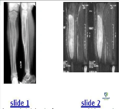Orthopedic Prometric Exam Chapter 3 Image