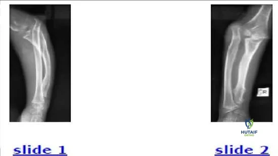 Orthopedic Prometric Exam Chapter 3 Image