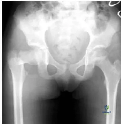 Orthopedic Prometric Exam Chapter 3 Image