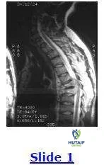 Orthopedic Prometric MCQs - Chapter 3 Part 23