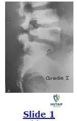 Orthopedic Prometric Exam Chapter 3 Image