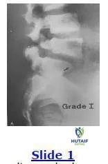 Orthopedic Prometric Exam Chapter 3 Image