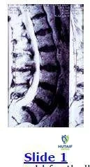 Orthopedic Prometric Exam Chapter 3 Image