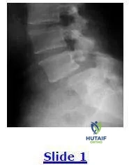 Orthopedic Prometric MCQs - Chapter 3 Part 24